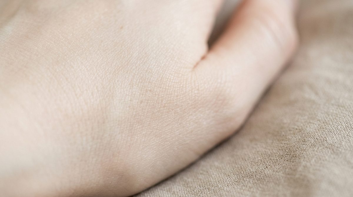 Blackheads and Whiteheads: The Truth About Comedones